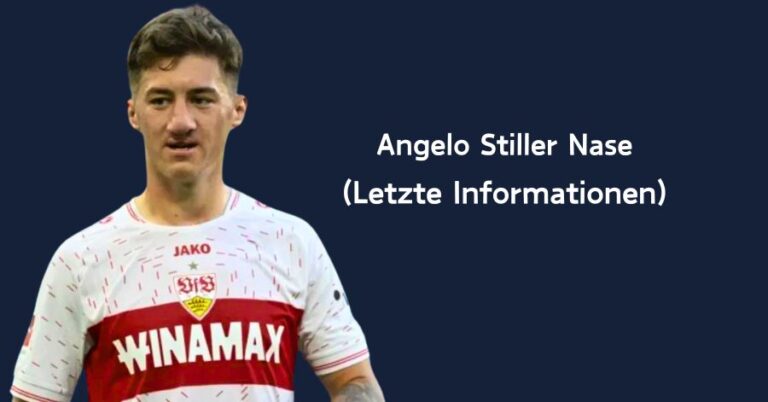 Angelo Stiller Nase (Letzte Informationen)